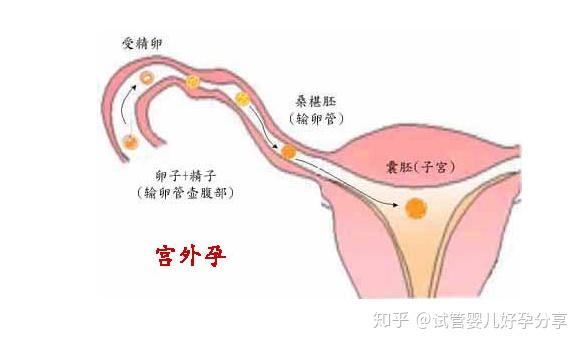 试管婴儿做一次多少钱北医三院